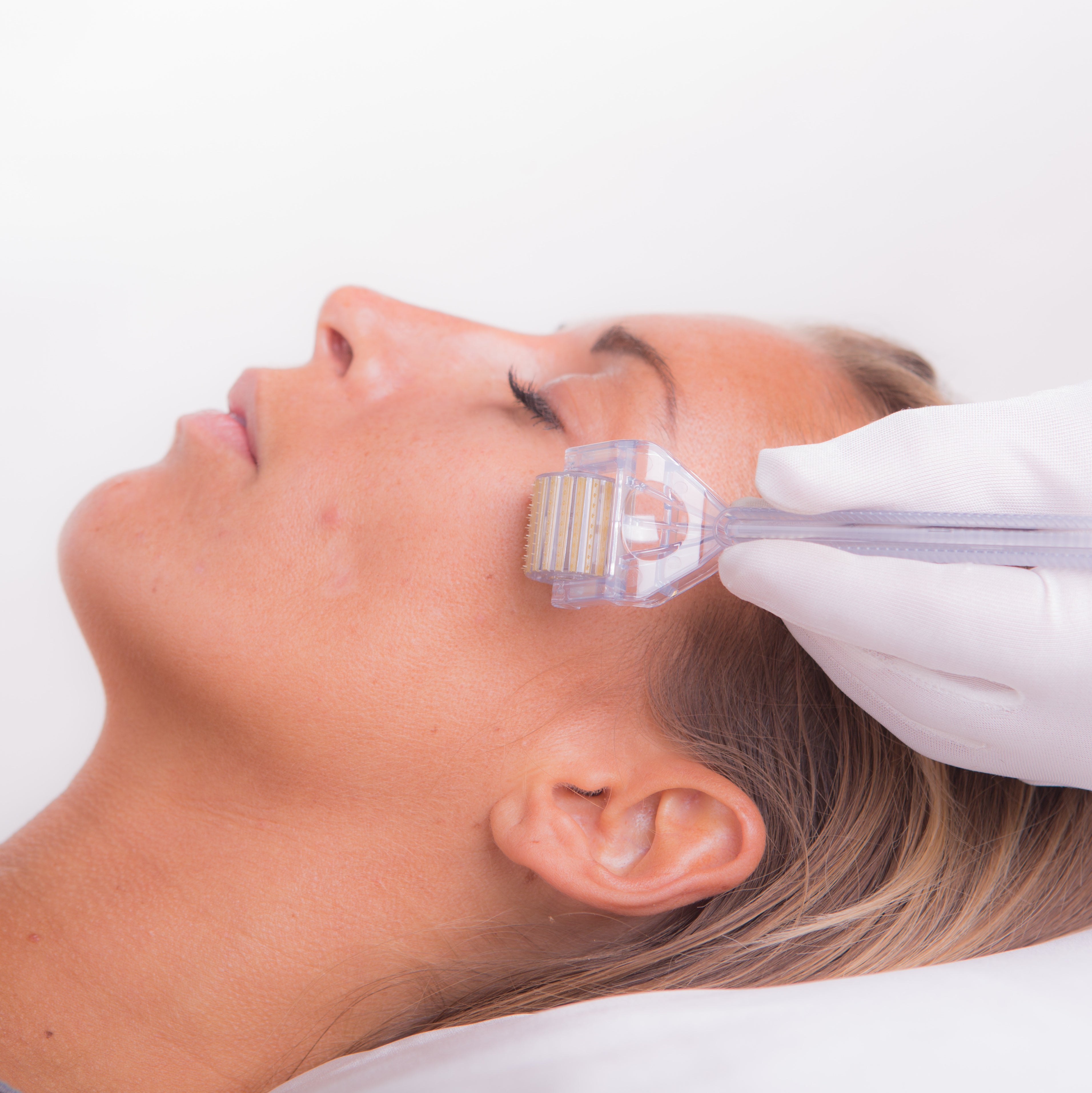 Why You Should Undergo Microneedling
