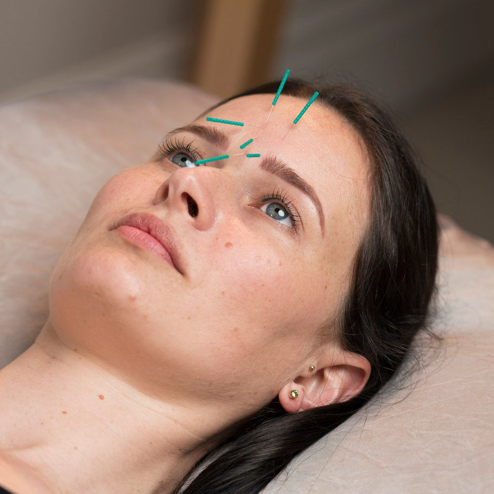 Acupuncture cosmétique holistique (cours)