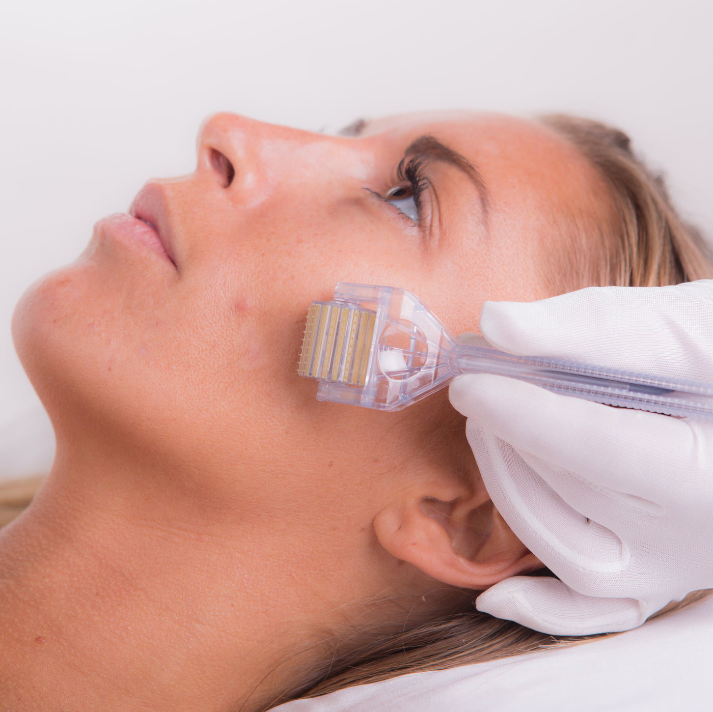 Skin Needling DVD  White Lotus 