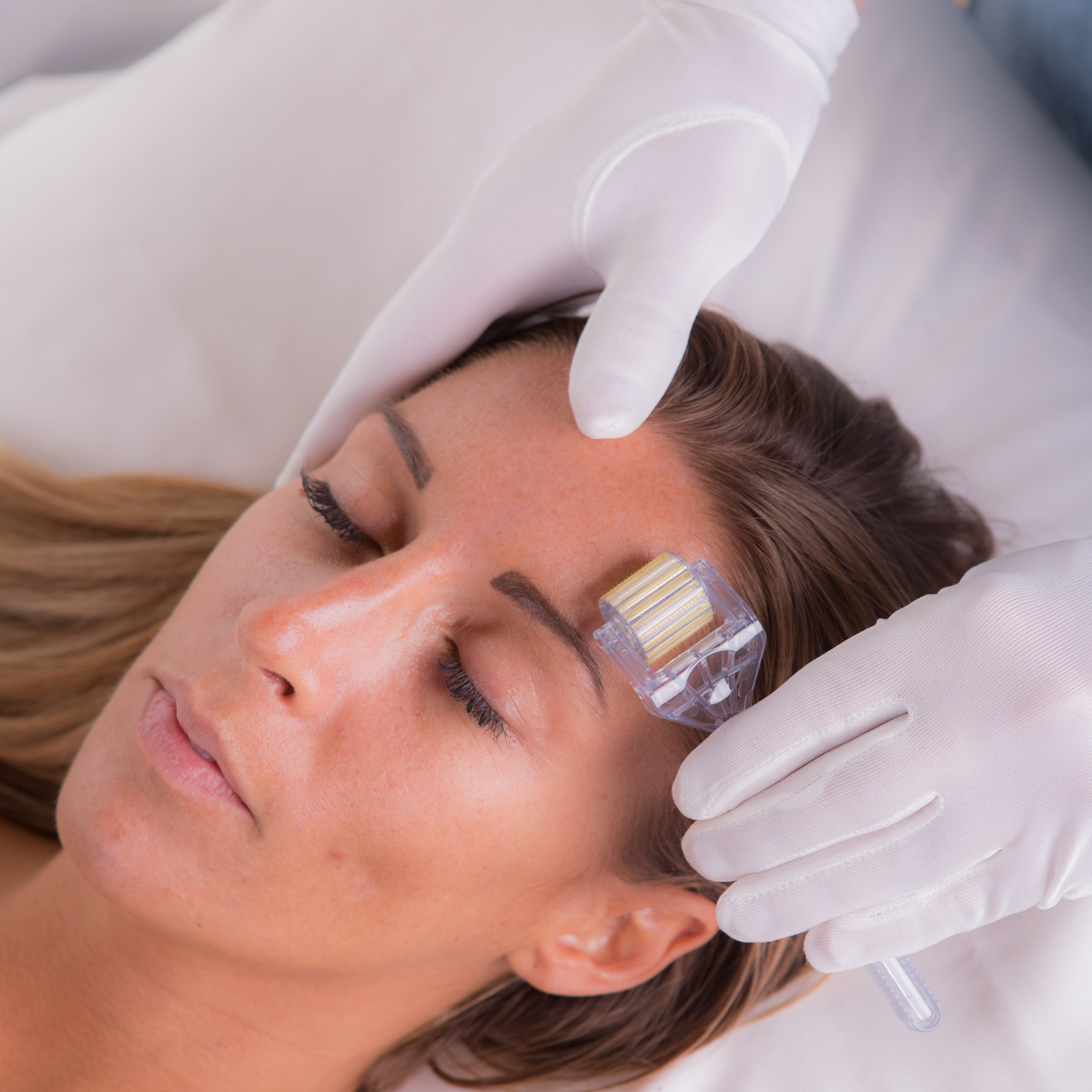 White Lotus Skin Needling As Seen On TV