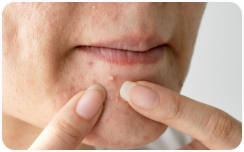 Wrinkles, sagging and the signs of aging
