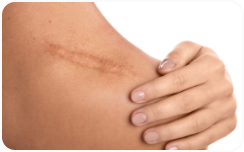 Wrinkles, sagging and the signs of aging