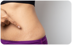 Wrinkles, sagging and the signs of aging